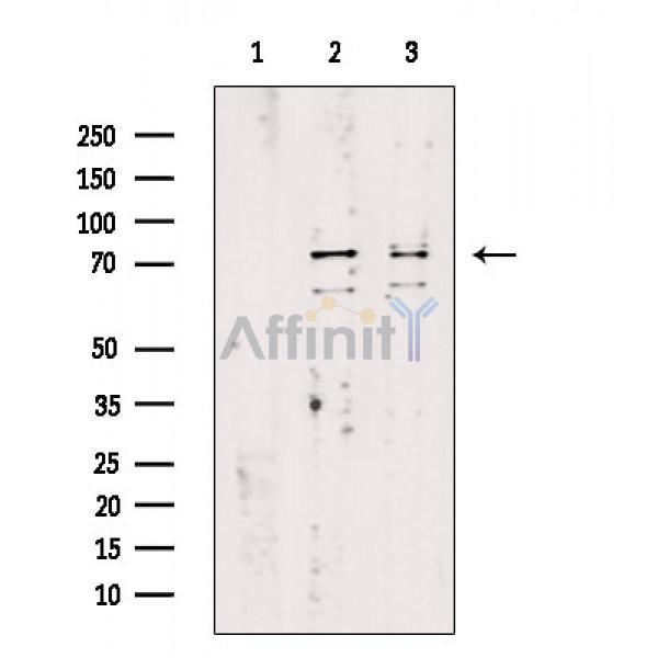 Валидация Affinity DF6553 - 17992