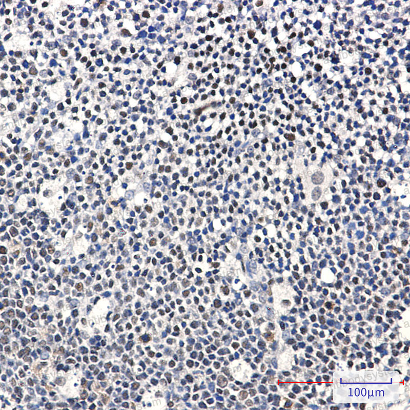 Валидация AntibodySystem RHG52101