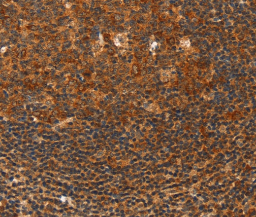 Иммуногистохимия, HDAC8, ткань миндалин человека