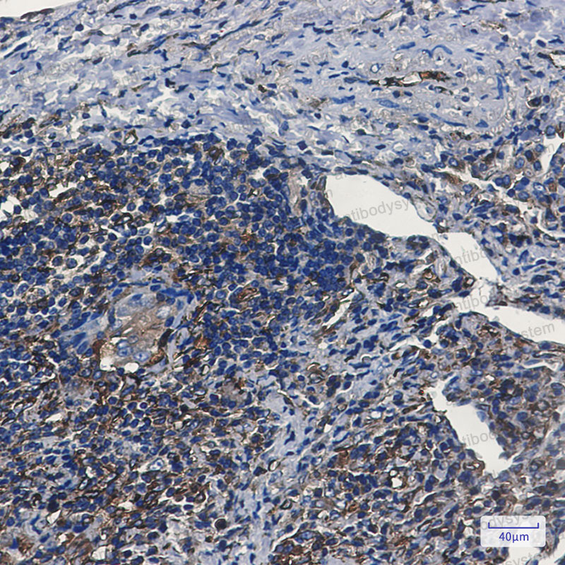 Валидация AntibodySystem RHD57101