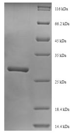 SDS-PAGE