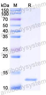 YHC59202, SDS-PAGE
