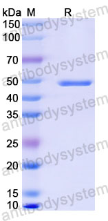 Валидация SDS-PAGE - AntibodySystem RVV13413