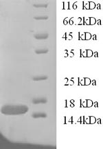 SDS-PAGE