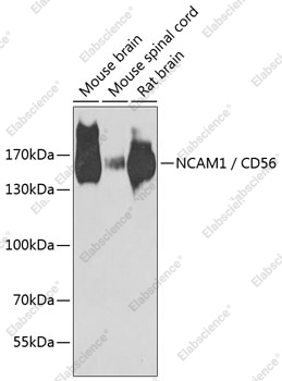 Вестерн-блоттинг, NCAM1/CD56, различные клеточные линии