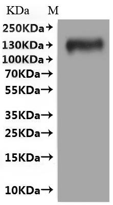 ИФА