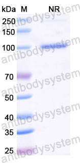 Валидация SDS-PAGE - AntibodySystem DHK06402