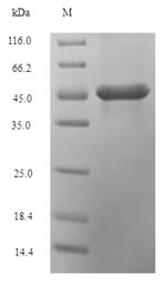SDS-PAGE