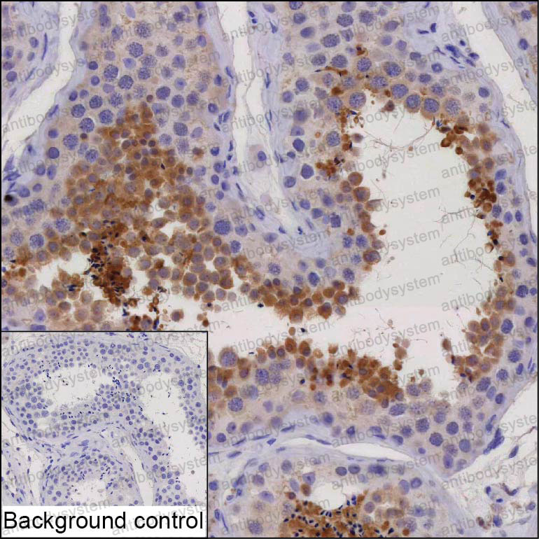 Валидация AntibodySystem RHP05102