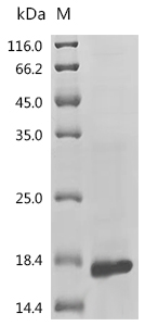 SDS-PAGE