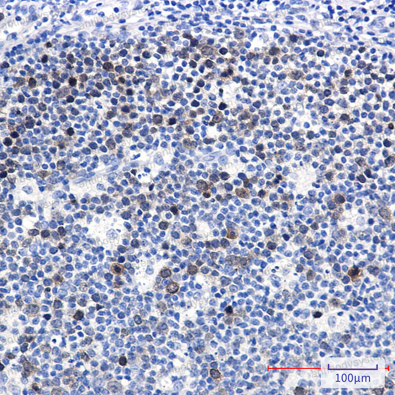 Валидация AntibodySystem RHA19001