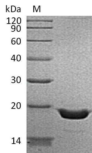 SDS-PAGE
