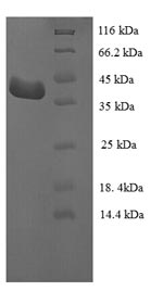 SDS-PAGE