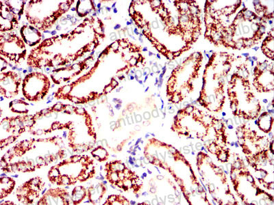 Валидация AntibodySystem RHC33504 (913)