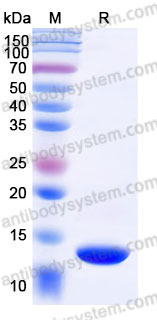 YHD19202, SDS-PAGE