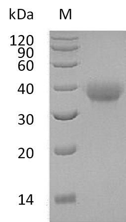 SDS-PAGE