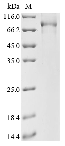 SDS-PAGE