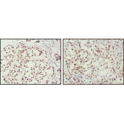 Валидация Affinity BF0300 - 5212