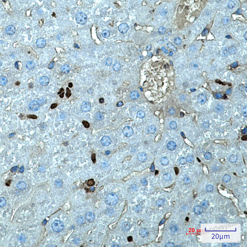 Валидация AntibodySystem RMD27301