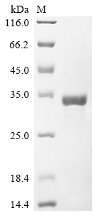 SDS-PAGE