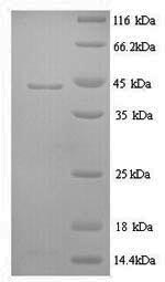 SDS-PAGE