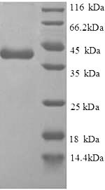 SDS-PAGE