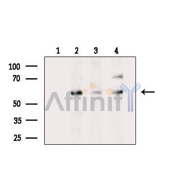 Валидация Affinity DF14042 - 9813