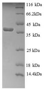 SDS-PAGE