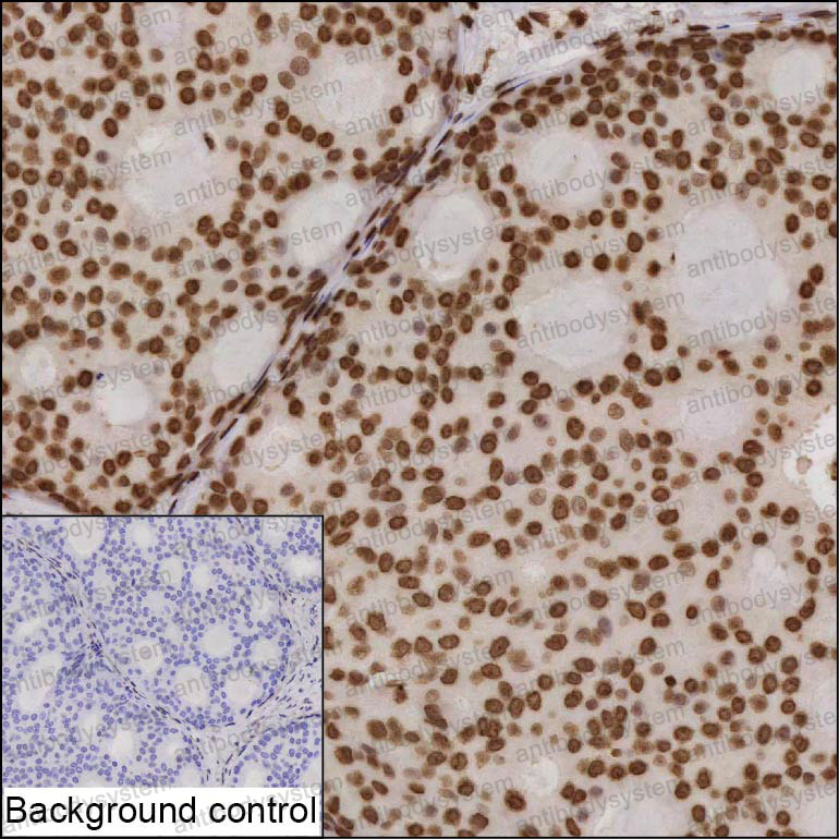 Валидация AntibodySystem RHB23701