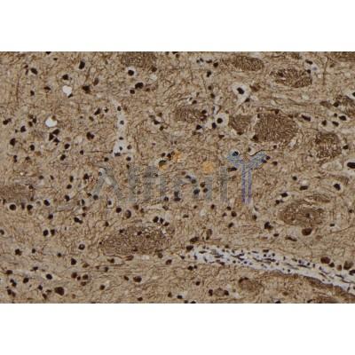 Валидация Affinity DF12321 - 6720