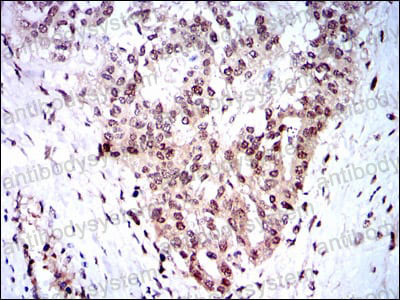 Валидация AntibodySystem RHF59703 (2580)