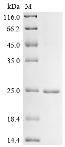SDS-PAGE