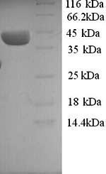 SDS-PAGE