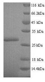 SDS-PAGE