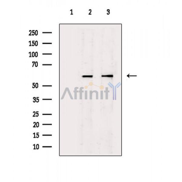 Валидация Affinity DF2621 - 13312