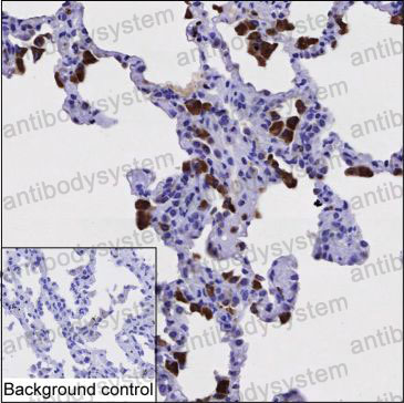 Валидация AntibodySystem RHD67802