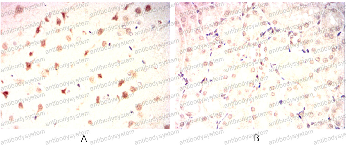 Валидация AntibodySystem RHK50101 (3687)