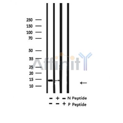 Валидация Affinity AF4354 - 2186