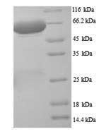SDS-PAGE