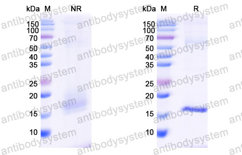 Валидация SDS-PAGE - AntibodySystem RXX51901