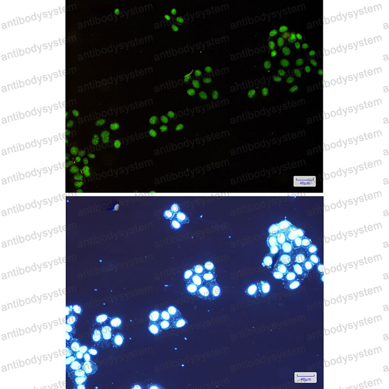 Валидация IF - AntibodySystem RHN75601