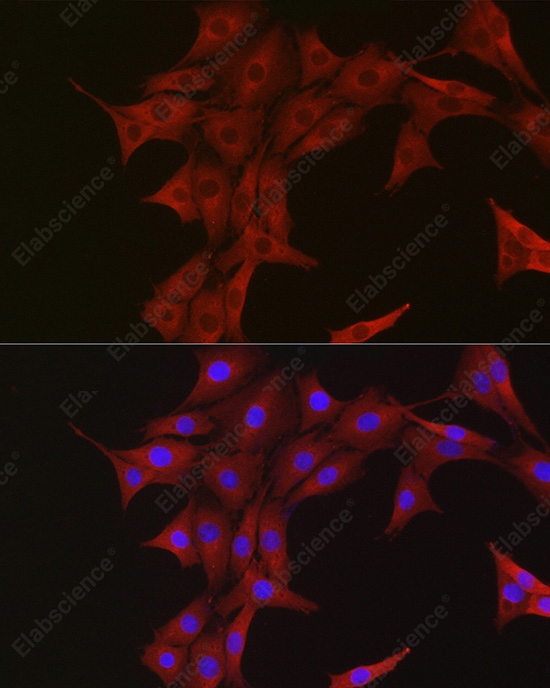 Иммунофлуоресценция, Ubiquitin, клетки PC-12