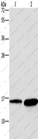 Вестерн-блоттинг, HINT2, ткань сердца мыши и гепатоцеллюлярная карцинома человека