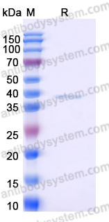 EHD62401, SDS-PAGE