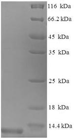 SDS-PAGE