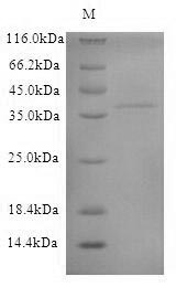 SDS-PAGE