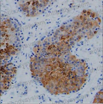 Валидация AntibodySystem RHF62204