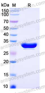 YHN90601, SDS-PAGE