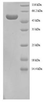 SDS-PAGE