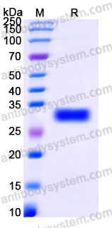YHP17601, SDS-PAGE